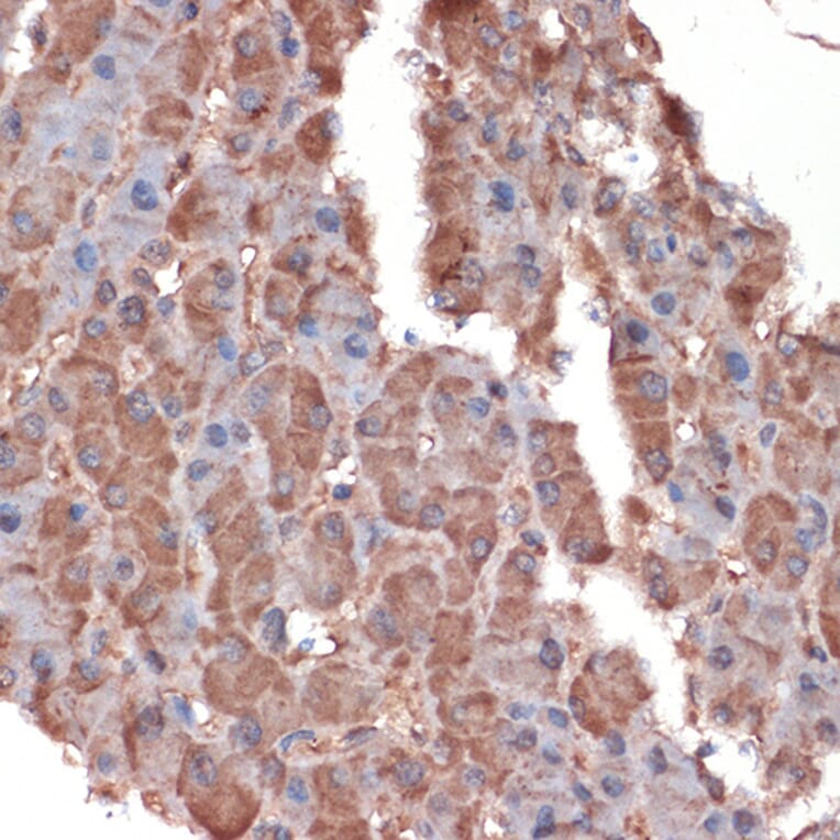 Immunohistochemistry - Anti-Apolipoprotein CIII Antibody [ARC1886] (A307674) - Antibodies.com