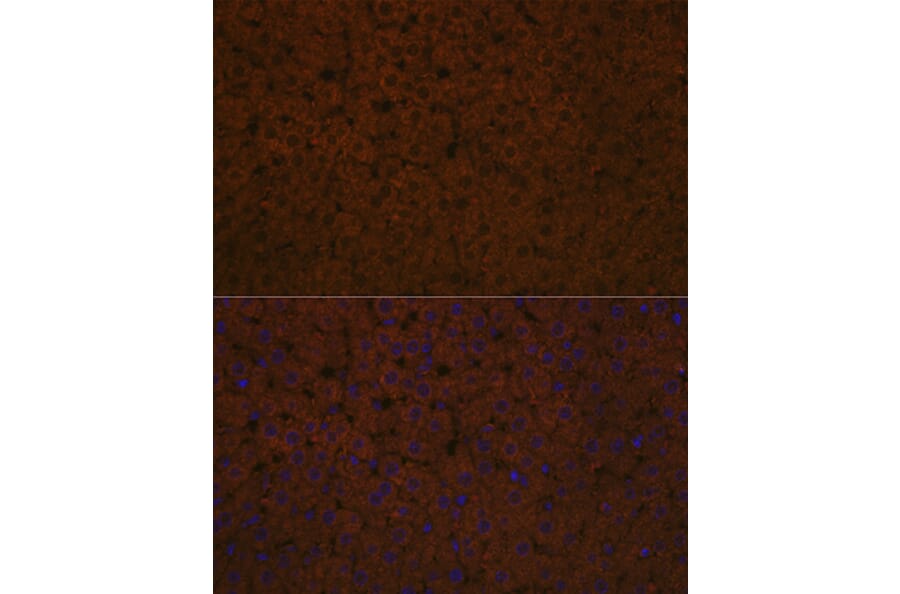 Immunofluorescence - Anti-Apolipoprotein CIII Antibody [ARC1886] (A307674) - Antibodies.com