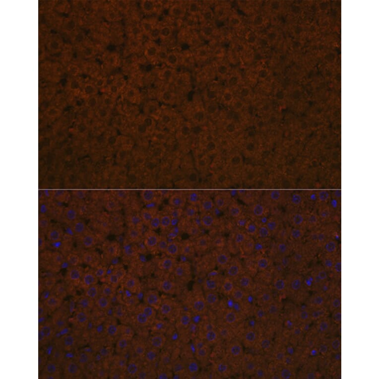 Immunofluorescence - Anti-Apolipoprotein CIII Antibody [ARC1886] (A307674) - Antibodies.com