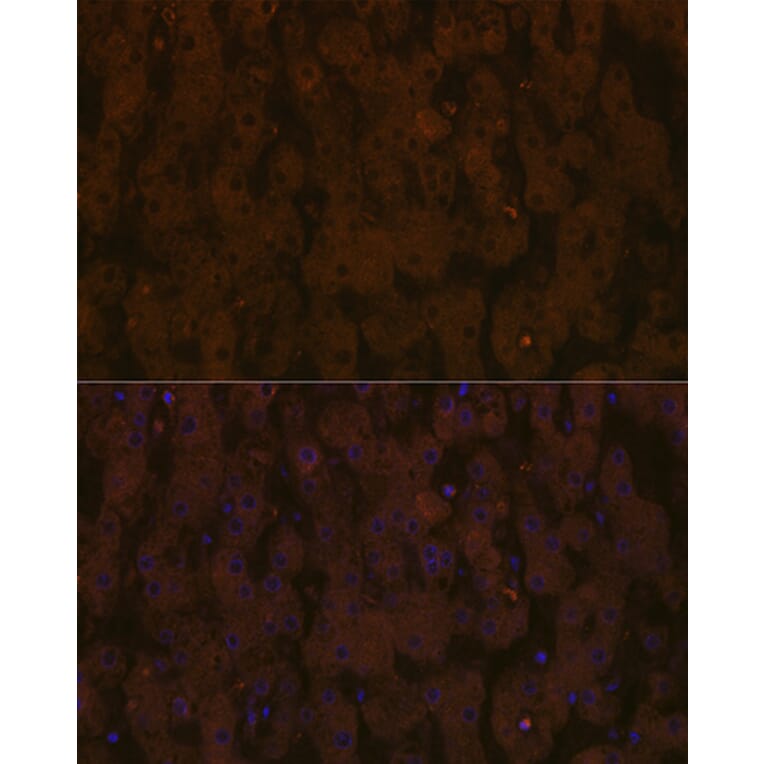 Immunofluorescence - Anti-Apolipoprotein CIII Antibody [ARC1886] (A307674) - Antibodies.com