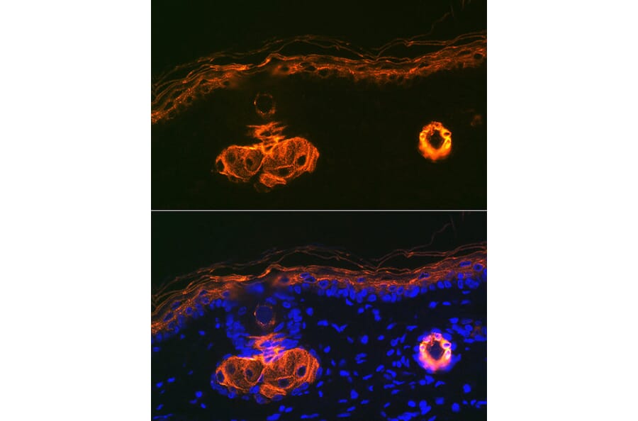 Immunofluorescence - Anti-Apolipoprotein CIII Antibody [ARC1886] (A307674) - Antibodies.com