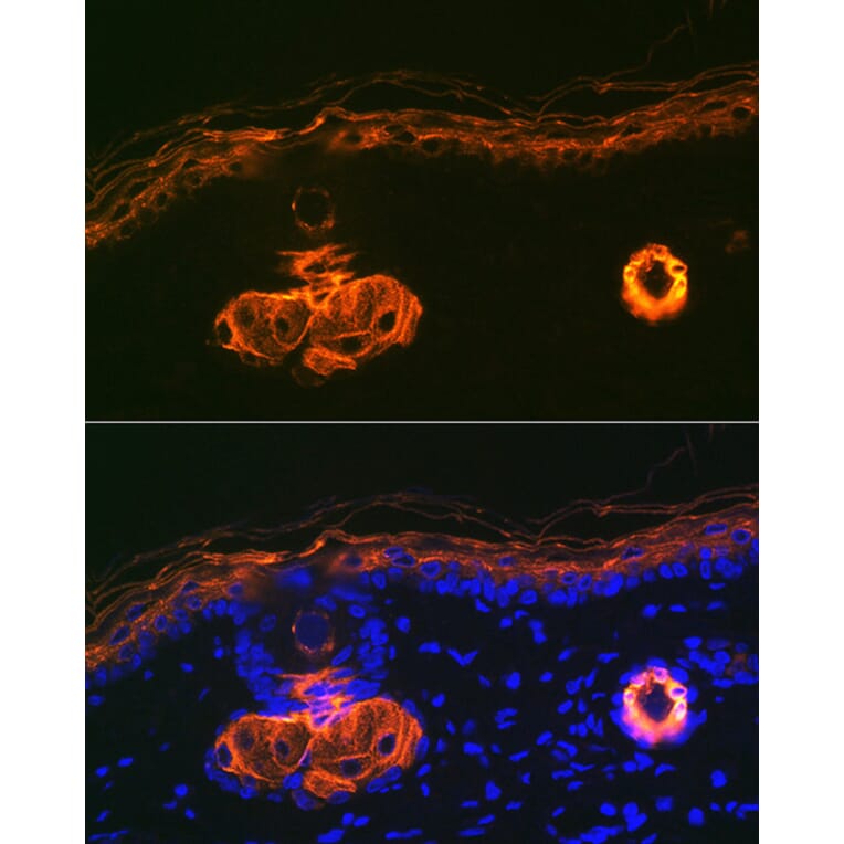 Immunofluorescence - Anti-Apolipoprotein CIII Antibody [ARC1886] (A307674) - Antibodies.com