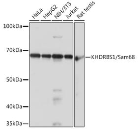 Western Blot - Anti-SAM68 Antibody [ARC0858] (A307676) - Antibodies.com