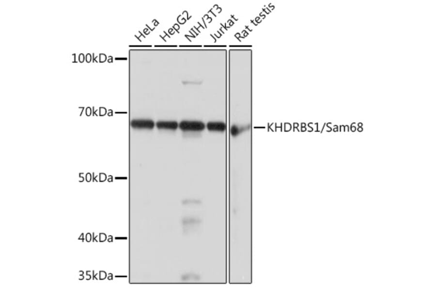 Western Blot - Anti-SAM68 Antibody [ARC0858] (A307676) - Antibodies.com