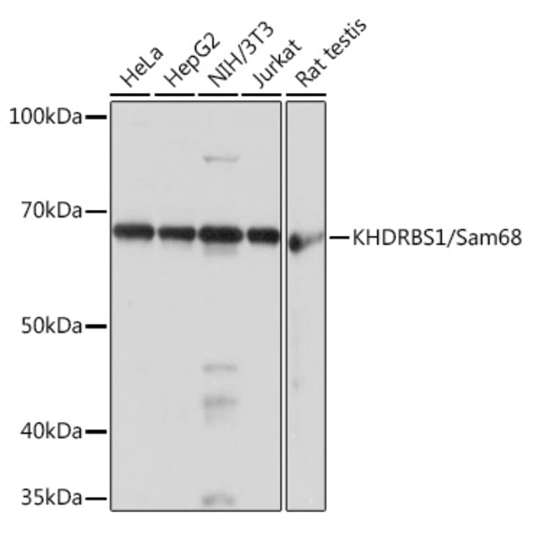 Western Blot - Anti-SAM68 Antibody [ARC0858] (A307676) - Antibodies.com