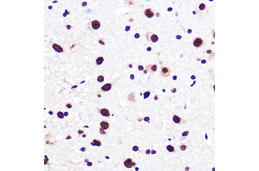 Immunohistochemistry - Anti-SAM68 Antibody [ARC0858] (A307676) - Antibodies.com