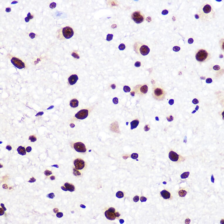 Immunohistochemistry - Anti-SAM68 Antibody [ARC0858] (A307676) - Antibodies.com