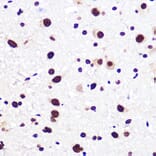 Immunohistochemistry - Anti-SAM68 Antibody [ARC0858] (A307676) - Antibodies.com