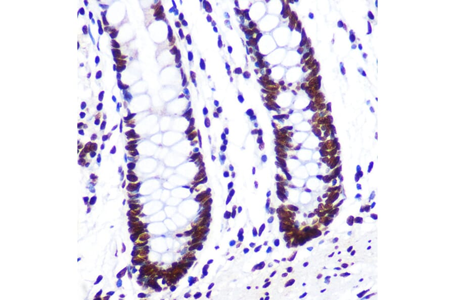 Immunohistochemistry - Anti-SAM68 Antibody [ARC0858] (A307676) - Antibodies.com