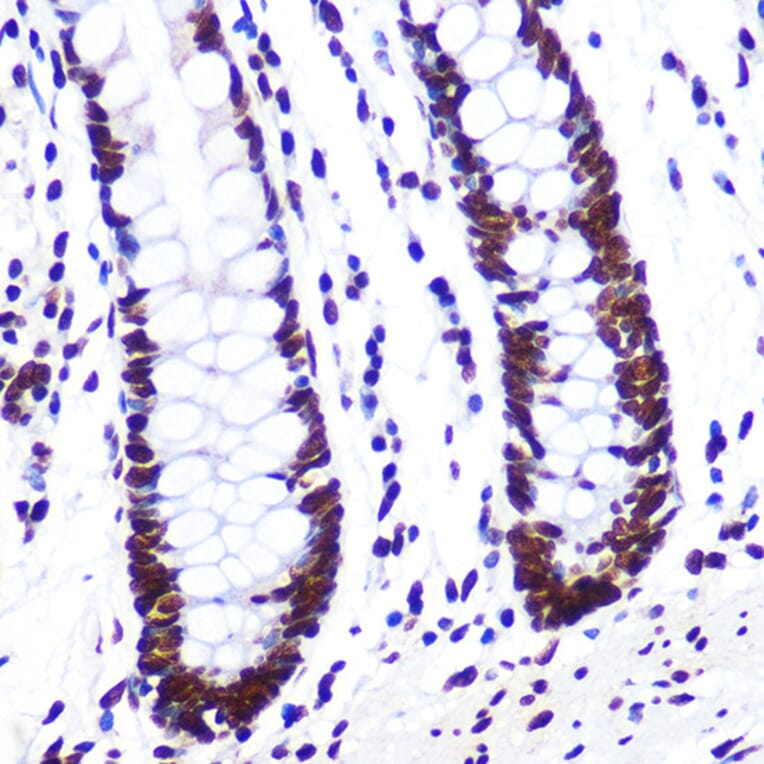 Immunohistochemistry - Anti-SAM68 Antibody [ARC0858] (A307676) - Antibodies.com