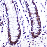 Immunohistochemistry - Anti-SAM68 Antibody [ARC0858] (A307676) - Antibodies.com