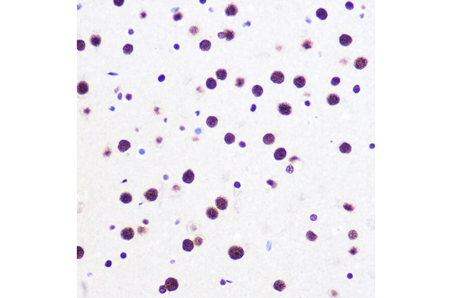 Immunohistochemistry - Anti-SAM68 Antibody [ARC0858] (A307676) - Antibodies.com