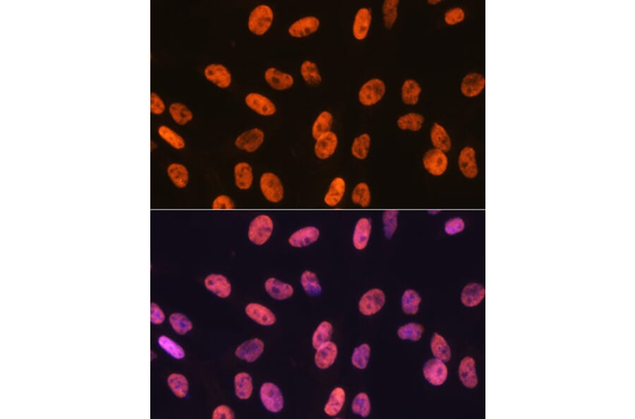 Immunofluorescence - Anti-SAM68 Antibody [ARC0858] (A307676) - Antibodies.com
