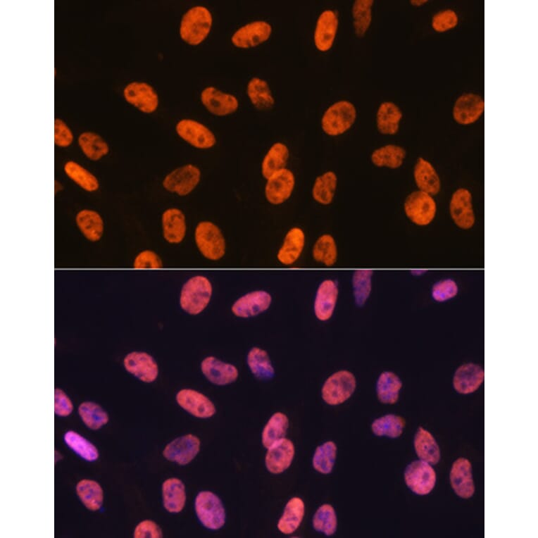 Immunofluorescence - Anti-SAM68 Antibody [ARC0858] (A307676) - Antibodies.com