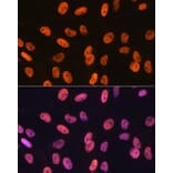 Immunofluorescence - Anti-SAM68 Antibody [ARC0858] (A307676) - Antibodies.com