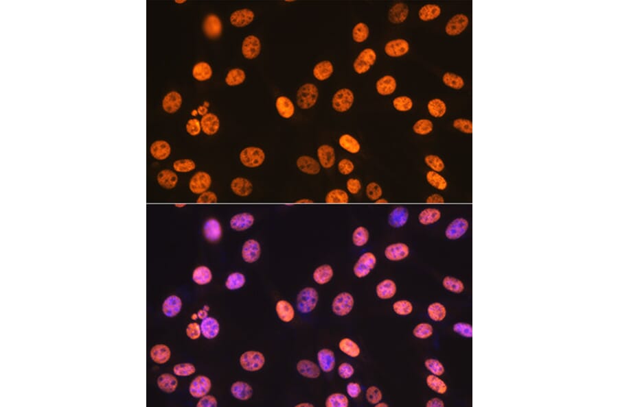Immunofluorescence - Anti-SAM68 Antibody [ARC0858] (A307676) - Antibodies.com
