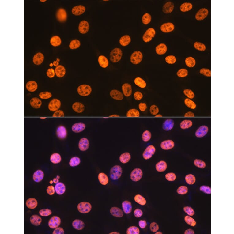 Immunofluorescence - Anti-SAM68 Antibody [ARC0858] (A307676) - Antibodies.com