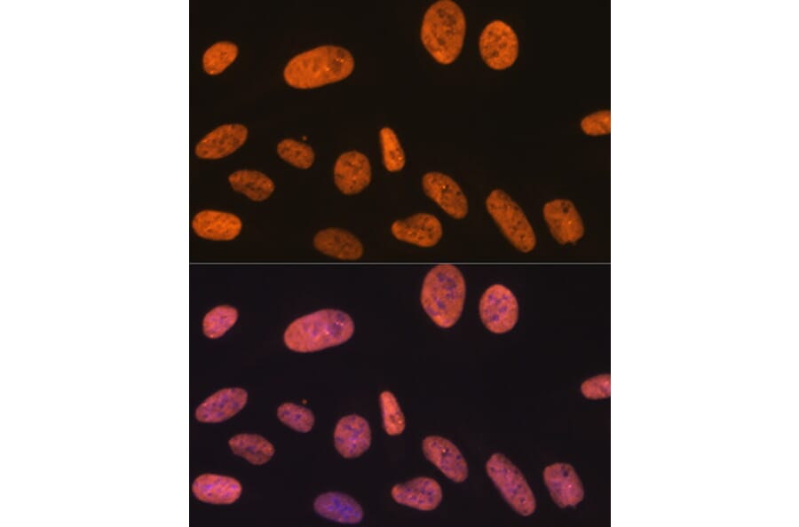 Immunofluorescence - Anti-SAM68 Antibody [ARC0858] (A307676) - Antibodies.com