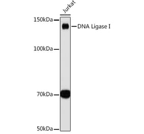 Western Blot - Anti-LIG1 Antibody [ARC1514] (A307677) - Antibodies.com