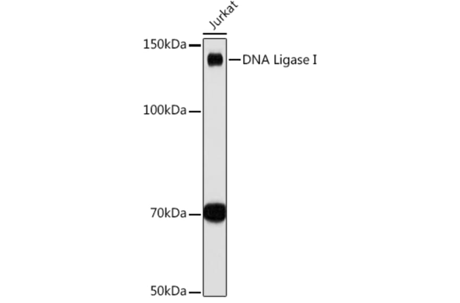 Western Blot - Anti-LIG1 Antibody [ARC1514] (A307677) - Antibodies.com