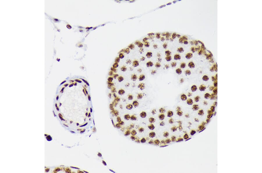 Immunohistochemistry - Anti-LIG1 Antibody [ARC1514] (A307677) - Antibodies.com