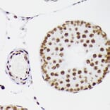 Immunohistochemistry - Anti-LIG1 Antibody [ARC1514] (A307677) - Antibodies.com