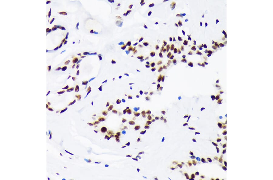 Immunohistochemistry - Anti-LIG1 Antibody [ARC1514] (A307677) - Antibodies.com