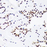 Immunohistochemistry - Anti-LIG1 Antibody [ARC1514] (A307677) - Antibodies.com