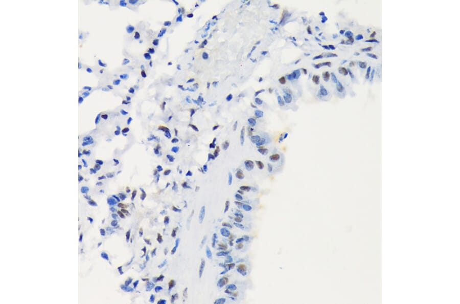 Immunohistochemistry - Anti-LIG1 Antibody [ARC1514] (A307677) - Antibodies.com