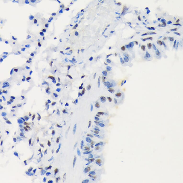 Immunohistochemistry - Anti-LIG1 Antibody [ARC1514] (A307677) - Antibodies.com