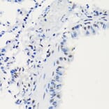 Immunohistochemistry - Anti-LIG1 Antibody [ARC1514] (A307677) - Antibodies.com