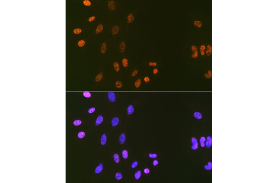 Immunofluorescence - Anti-LIG1 Antibody [ARC1514] (A307677) - Antibodies.com