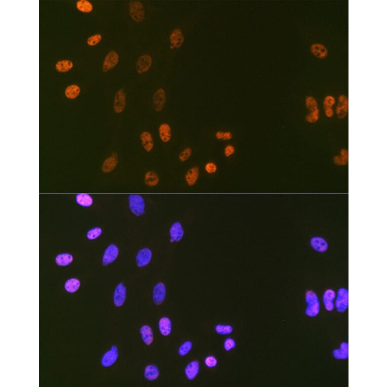 Immunofluorescence - Anti-LIG1 Antibody [ARC1514] (A307677) - Antibodies.com