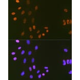 Immunofluorescence - Anti-LIG1 Antibody [ARC1514] (A307677) - Antibodies.com