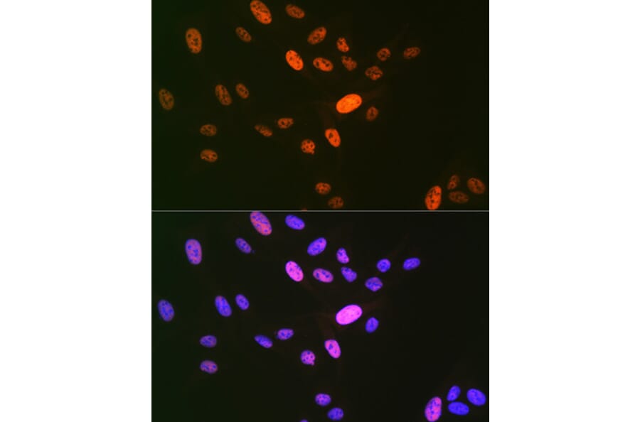 Immunofluorescence - Anti-LIG1 Antibody [ARC1514] (A307677) - Antibodies.com