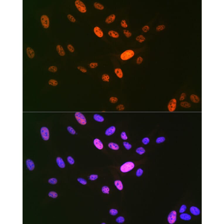 Immunofluorescence - Anti-LIG1 Antibody [ARC1514] (A307677) - Antibodies.com