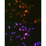 Immunofluorescence - Anti-LIG1 Antibody [ARC1514] (A307677) - Antibodies.com
