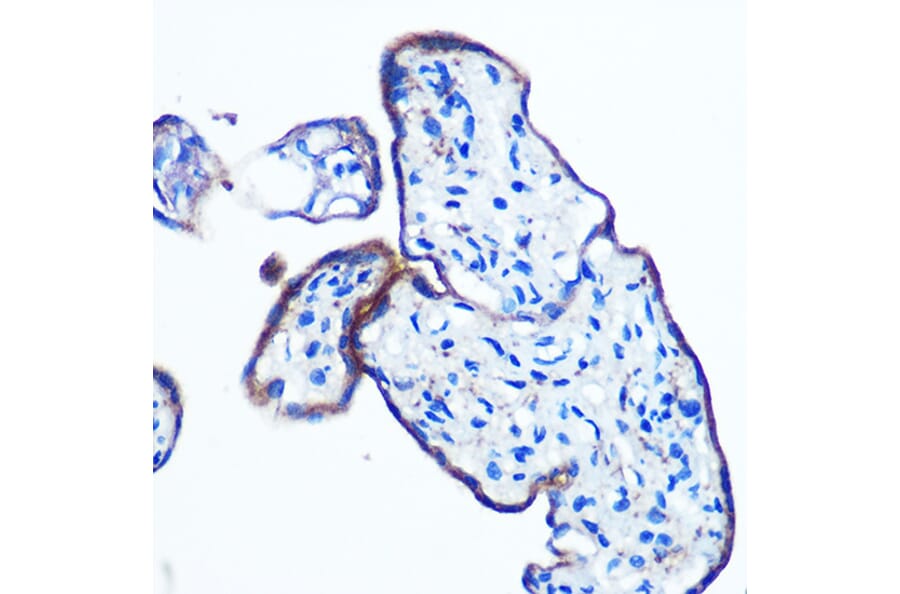 Immunohistochemistry - Anti-IKKi/IKKe Antibody [ARC0781] (A307678) - Antibodies.com