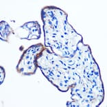 Immunohistochemistry - Anti-IKKi/IKKe Antibody [ARC0781] (A307678) - Antibodies.com