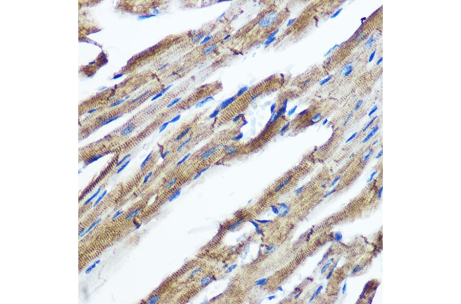 Immunohistochemistry - Anti-IKKi/IKKe Antibody [ARC0781] (A307678) - Antibodies.com