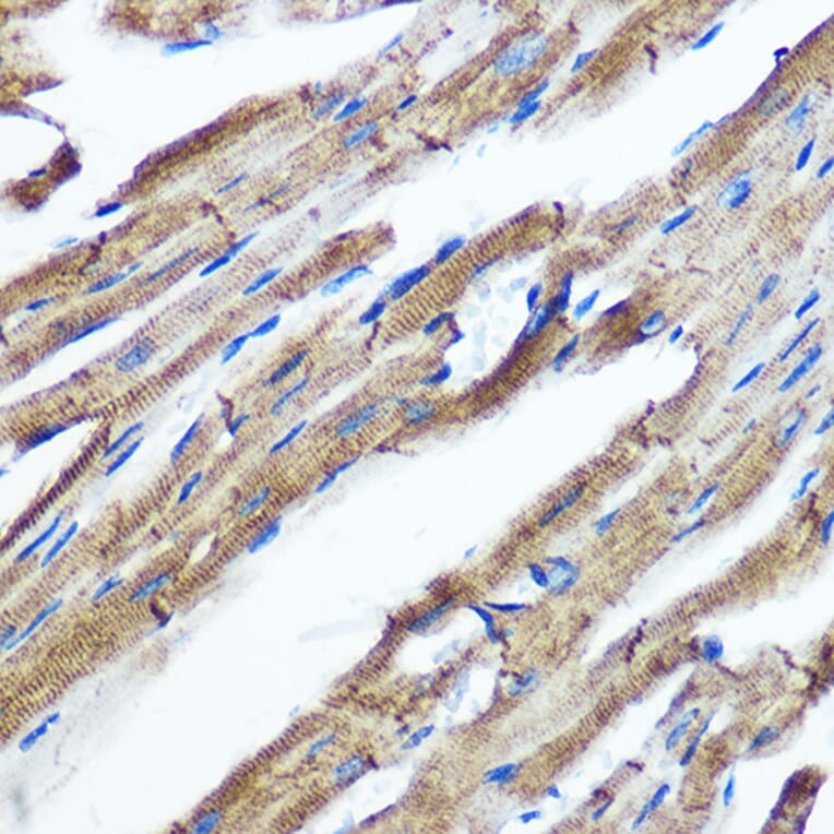 Immunohistochemistry - Anti-IKKi/IKKe Antibody [ARC0781] (A307678) - Antibodies.com
