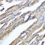 Immunohistochemistry - Anti-IKKi/IKKe Antibody [ARC0781] (A307678) - Antibodies.com