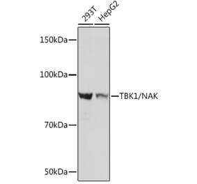 Western Blot - Anti-NAK/TBK1 Antibody [ARC0778] (A307679) - Antibodies.com