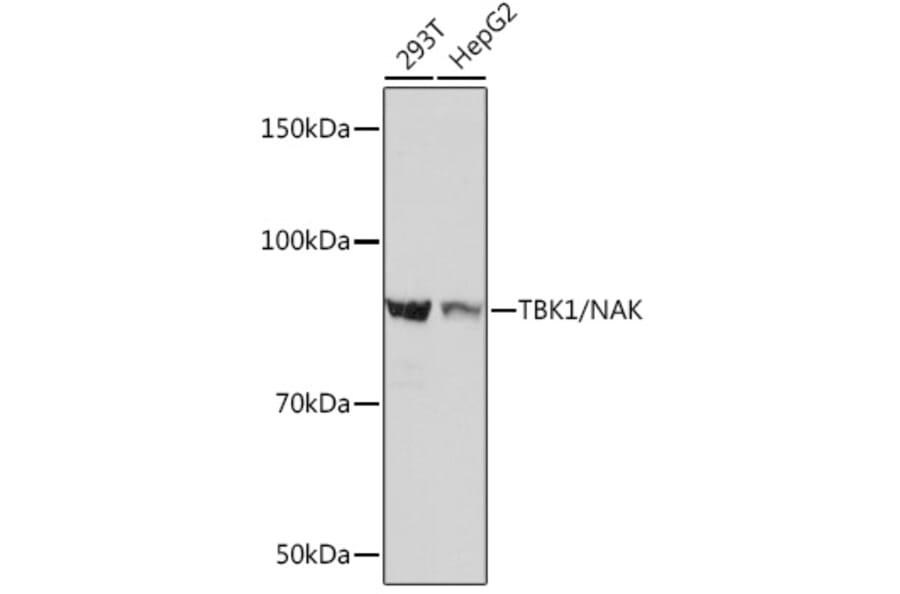 Western Blot - Anti-NAK/TBK1 Antibody [ARC0778] (A307679) - Antibodies.com