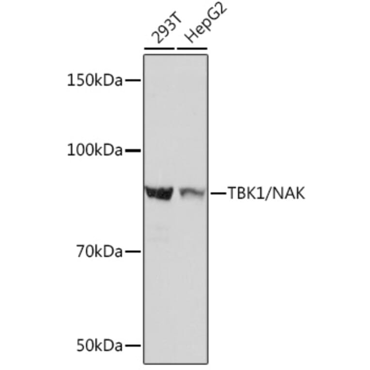 Western Blot - Anti-NAK/TBK1 Antibody [ARC0778] (A307679) - Antibodies.com