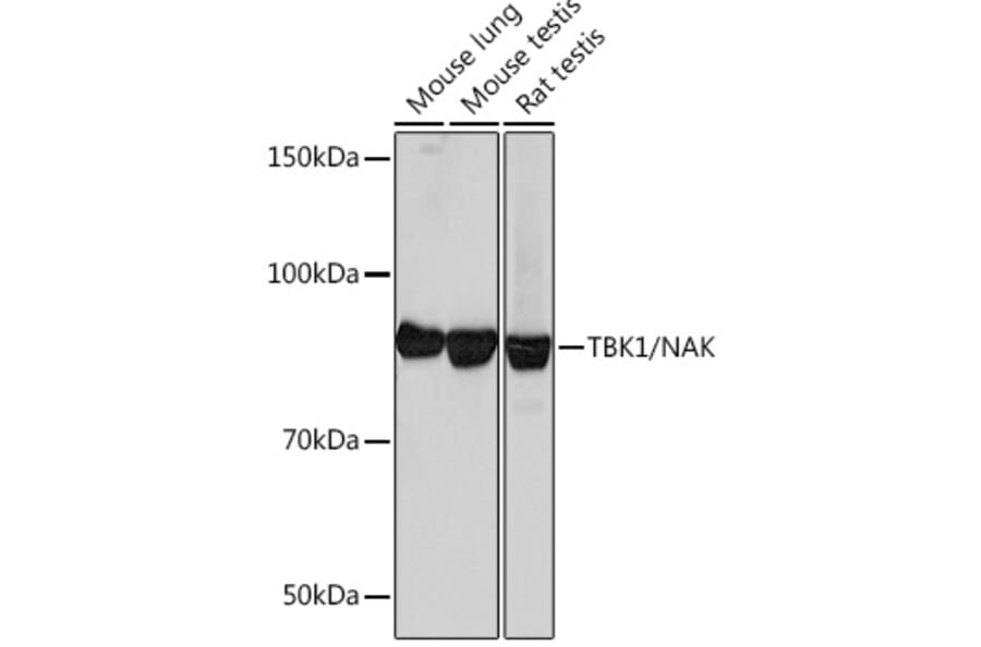Western Blot - Anti-NAK/TBK1 Antibody [ARC0778] (A307679) - Antibodies.com