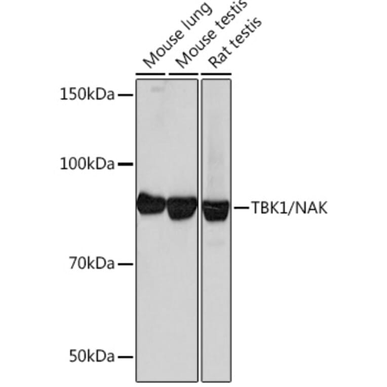 Western Blot - Anti-NAK/TBK1 Antibody [ARC0778] (A307679) - Antibodies.com