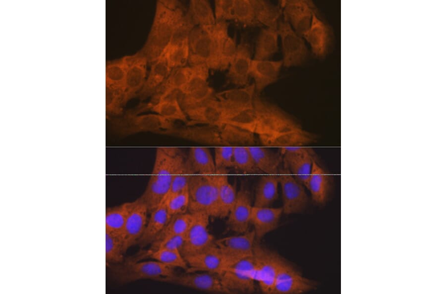 Immunofluorescence - Anti-NAK/TBK1 Antibody [ARC0778] (A307679) - Antibodies.com