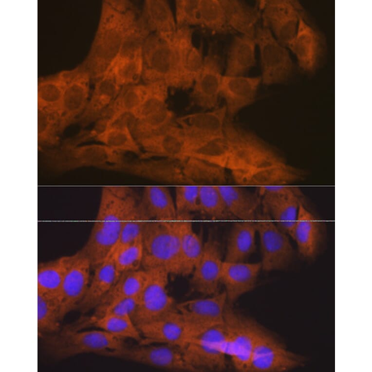 Immunofluorescence - Anti-NAK/TBK1 Antibody [ARC0778] (A307679) - Antibodies.com