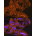 Immunofluorescence - Anti-NAK/TBK1 Antibody [ARC0778] (A307679) - Antibodies.com